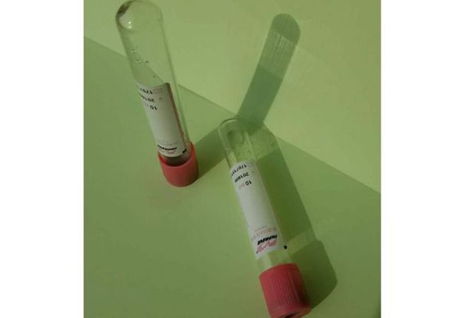 DNA血样保存管