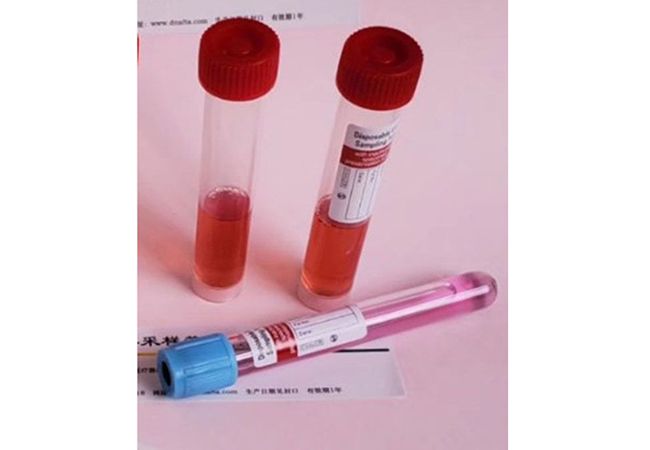 一次性使用病毒采样管